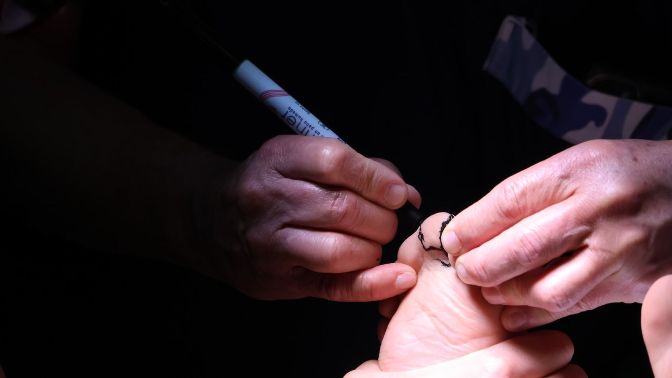 En el sector privado una cirugía de este tipo cuesta entre 70 y 80 mil pesos WhatsApp Image 2025 08 09 at 12.44.30 PM